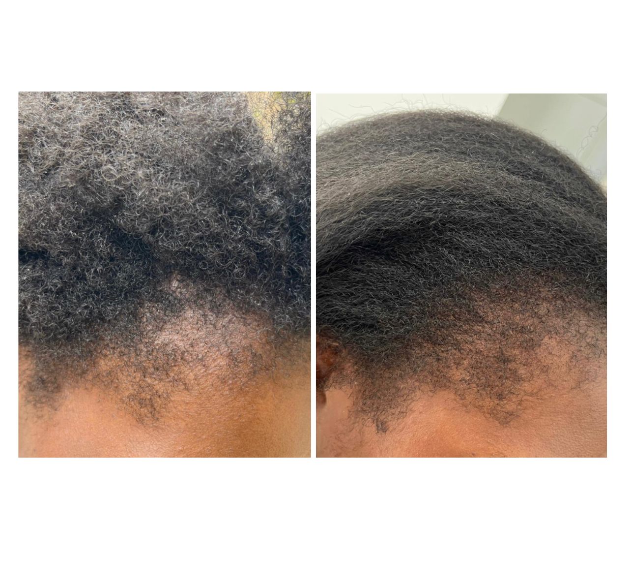 Huile Réparatrice pour Cheveux