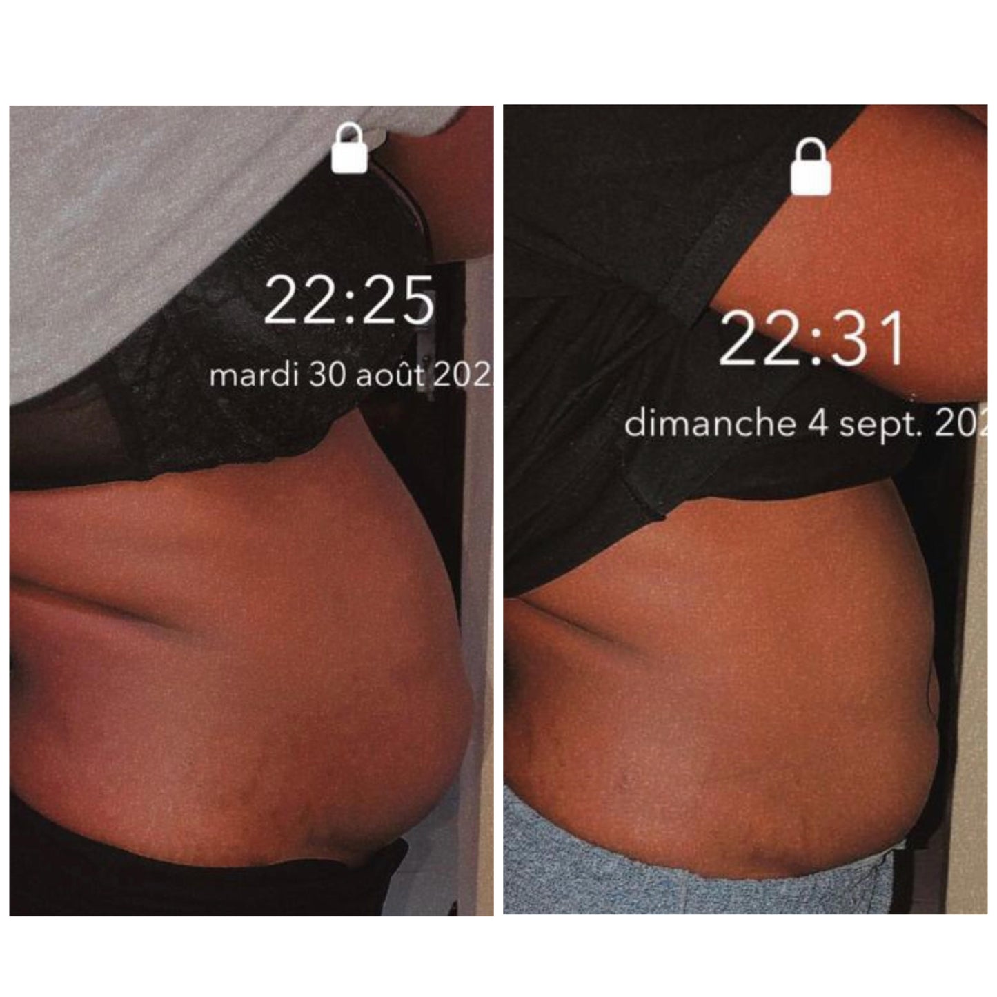 Infusion Ventre Plat